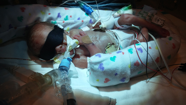 Little Hats, Big Hearts - Declan's Preemie Story